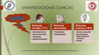 MANIFESTACIONES CLINICAS
Síntomas
visuales (99%)
•Alucinaciones
•Escotomas 66%
•Fotopsias
•Metamorfopsias
Síntomas
sensoriales
•Parestesias
•Hipoestesias
Síntomas
motores (18%)
•Ataxia sensorial
•Movimientos
hipercineticos
(coreas)
•Afasia
Toro Gómez, Jaime y colaboradores , Neurología , 2ª edición,Cap.16 ,pag.431-450, Editorial Manual Moderno,2012.
 