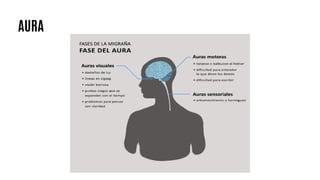 AURA
 