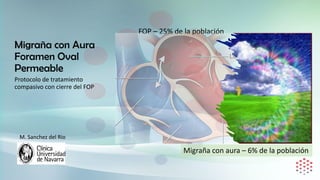 Migraña con Aura
Foramen Oval
Permeable
FOP – 25% de la población
Protocolo de tratamiento
compasivo con cierre del FOP
Migraña con aura – 6% de la población
M. Sanchez del Rio
 