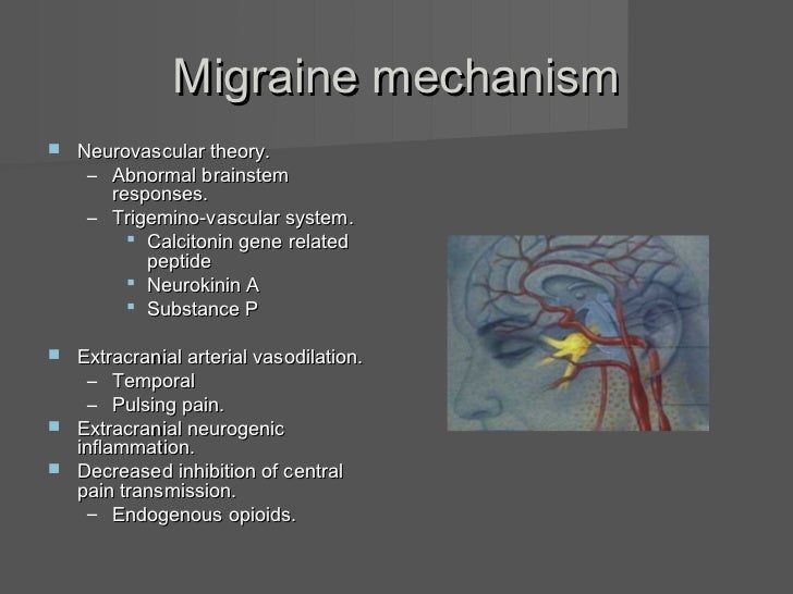 Migraine Migraine