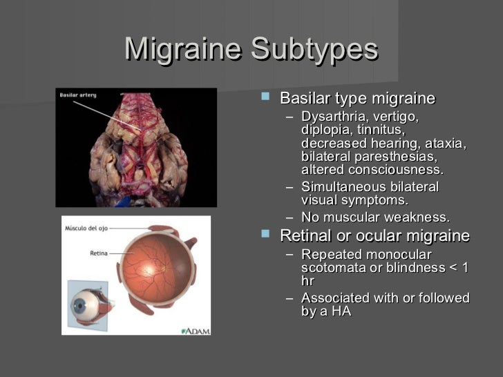 What are the causes of an optical migraine?