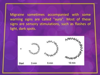 Migraine Examples Migraine | PPTX