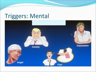 Migraine its presentation and management | PPT