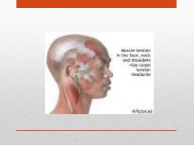 Migraine - SAKIT KEPALA