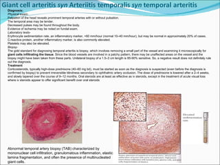 Diagnosis: Physical exam- Palpation of the head reveals prominent temporal arteries with or without pulsation.  The temporal area may be tender.  Decreased pulses may be found throughout the body.  Evidence of ischemia may be noted on fundal exam.  Laboratory tests- Erythrocyte sedimentation rate, an inflammatory marker, >60 mm/hour (normal 10–40 mm/hour), but may be normal in approximately 20% of cases.  C-reactive protein, another inflammatory marker, is also commonly elevated.  Platelets may also be elevated.  Biopsy- The gold standard for diagnosing temporal arteritis is biopsy, which involves removing a small part of the vessel and examining it microscopically for  giant cells infiltrating the tissue . Since the blood vessels are involved in a patchy pattern, there may be unaffected areas on the vessel and the biopsy might have been taken from these parts. Unilateral biopsy of a 1.5–3 cm length is 85-90% sensitive. So, a negative result does not definitely rule out the diagnosis. Treatment Corticosteroids, typically high-dose prednisone (40–60 mg bd), must be started as soon as the diagnosis is suspected (even before the diagnosis is confirmed by biopsy) to prevent irreversible blindness secondary to ophthalmic artery occlusion. The dose of prednisone is lowered after a 2–4 weeks, and slowly tapered over the course of 9–12 months. Oral steroids are at least as effective as iv steroids, except in the treatment of acute visual loss where iv steroids appear to offer significant benefit over oral steroids  Abnormal temporal artery biopsy (TAB) characterized by mononuclear cell infiltration, granulomatous inflammation, elastic lamina fragmentation, and often the presence of multinucleated giant cells. 