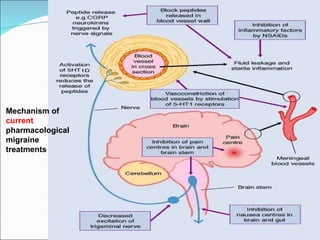 Mechanism of  current  pharmacological migraine treatments 