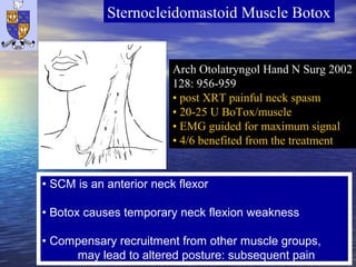 Neck Botox Injection Scm Migraine and BoTox 2013 | PPT