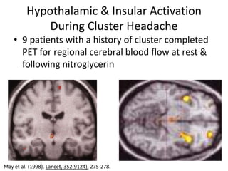Pathophysiology Migraine Headache PPTX
