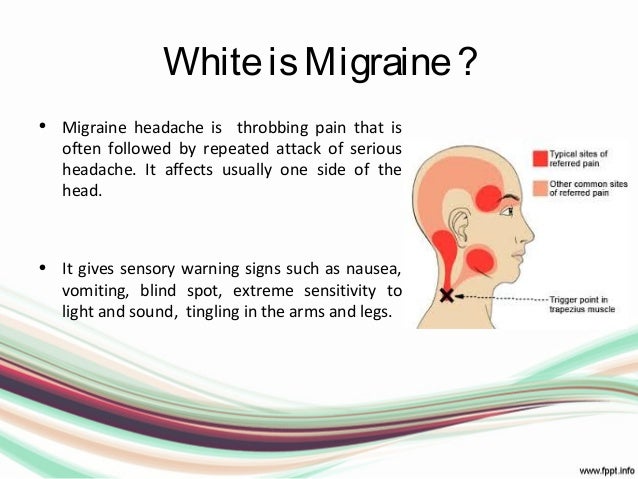 What is a migraine headache?