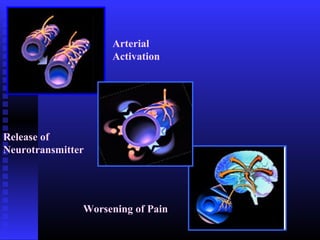Arterial
                    Activation




Release of
Neurotransmitter




               Worsening of Pain
 