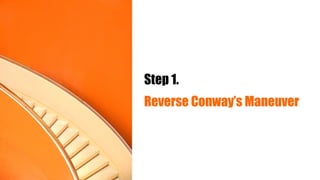 Step 1.
Reverse Conway’s Maneuver
 