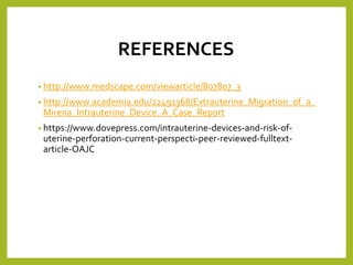 Migration Risk Iud Migration of iud (dr.rafi rozan) | PPTX