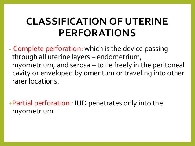 Migration Risk Iud Iud Perforation Symptoms
