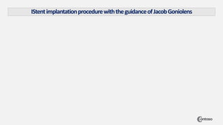 IStentimplantationprocedurewiththeguidanceofJacobGoniolens
 