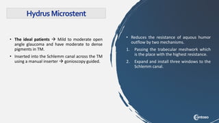 • The ideal patients  Mild to moderate open
angle glaucoma and have moderate to dense
pigments in TM.
• Inserted into the Schlemm canal across the TM
using a manual inserter  gonioscopy guided.
HydrusMicrostent
• Reduces the resistance of aquous humor
outflow by two mechanisms.
1. Passing the trabecular meshwork which
is the place with the highest resistance.
2. Expand and install three windows to the
Schlemm canal.
 