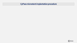 CyPassmicrostentimplantationprocedure
 