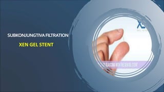 SUBKONJUNGTIVAFILTRATION
XEN GEL STENT
 