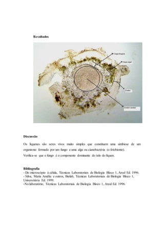 Resultados
Discussão
Os líquenes são seres vivos muito simples que constituem uma simbiose de um
organismo formado por um fungo e uma alga ou cianobactéria (o fotobionte).
Verifica-se que o fungo é o componente dominante do talo do líquen.
Bibliografia
- Do microscópio á célula, Técnicas Laboratoriais de Biologia Bloco 1, Areal Ed. 1996.
- Silva, Maria Amélia e outros, Biolab, Técnicas Laboratoriais de Biologia Bloco 1,
Universitária Ed. 1999.
-No laboratório, Técnicas Laboratoriais de Biologia Bloco 1, Areal Ed. 1996.
 