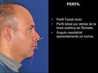 Miguel Osorio Autorizado 2.pptx