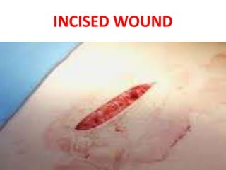 INCISED WOUND
 