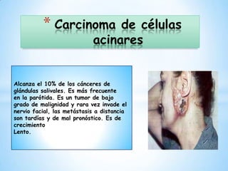 * Carcinoma            de células
                            acinares


Alcanza el 10% de los cánceres de
glándulas salivales. Es más frecuente
en la parótida. Es un tumor de bajo
grado de malignidad y rara vez invade el
nervio facial, las metástasis a distancia
son tardías y de mal pronóstico. Es de
crecimiento
Lento.
 