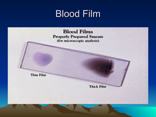 Blood Film 