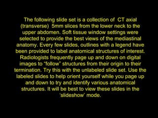 Mike's CT Chest tests, ct scan education | PPT