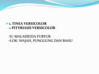  1. TINEA VERSICOLOR
= PITYRIASIS VERSICOLOR
•E/ MALASSEZIA FURFUR
•LOK: WAJAH, PUNGGUNG DAN BAHU
 