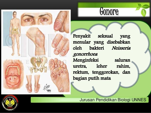 hubungan mikroba (bakteri) terhadap penyakit