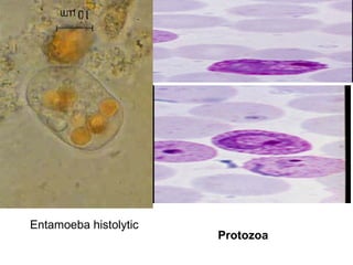 Entamoeba histolytic
                       Protozoa
 