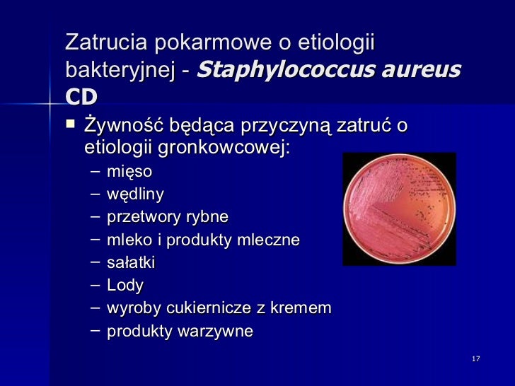 Mikroorganizmy Znajdujące Się W Przewodzie Pokarmowym Roślinożerców Mikroorganizmy chorobotwórcze w żywności