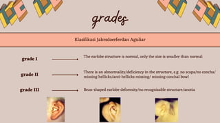 mikrotia(small ear) congenital disease in ENT.pptx