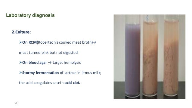 blood test target glucose clostridium.perfringenes blood test target glucose clostridium.perfringenes