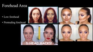 Forehead Area
• Low forehead
• Protruding forehead
 