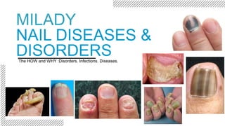 MILADY
NAIL DISEASES &
DISORDERSThe HOW and WHY :Disorders. Infections. Diseases.
 