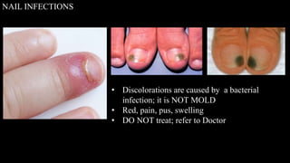 Milady nail disease &amp; disorder | PPT