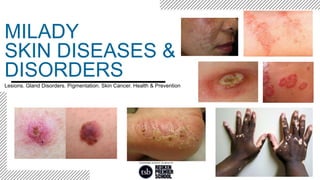 Lesions. Gland Disorders. Pigmentation. Skin Cancer. Health & Prevention
MILADY
SKIN DISEASES &
DISORDERS
 