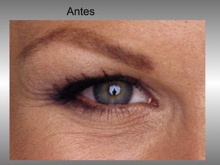 Antes 