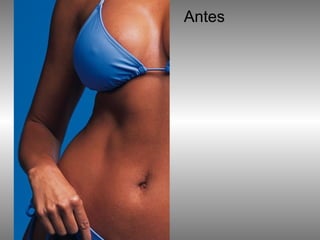 Antes 