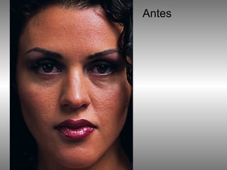Antes 