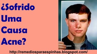 ¿Sofrido
Uma
Causa
Acne?
http://remediosparaespinhas.blogspot.com/

 