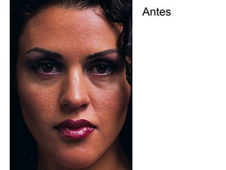 Antes