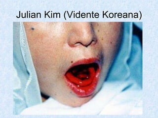 Julian Kim (Vidente Koreana) 
