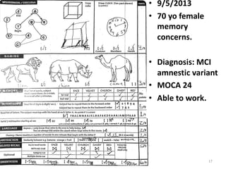 Mild cognitive impairment | PDF