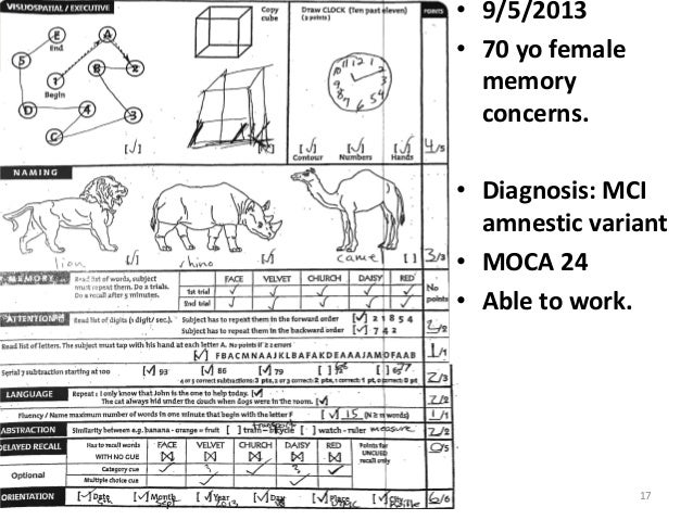 Mild cognitive impairment