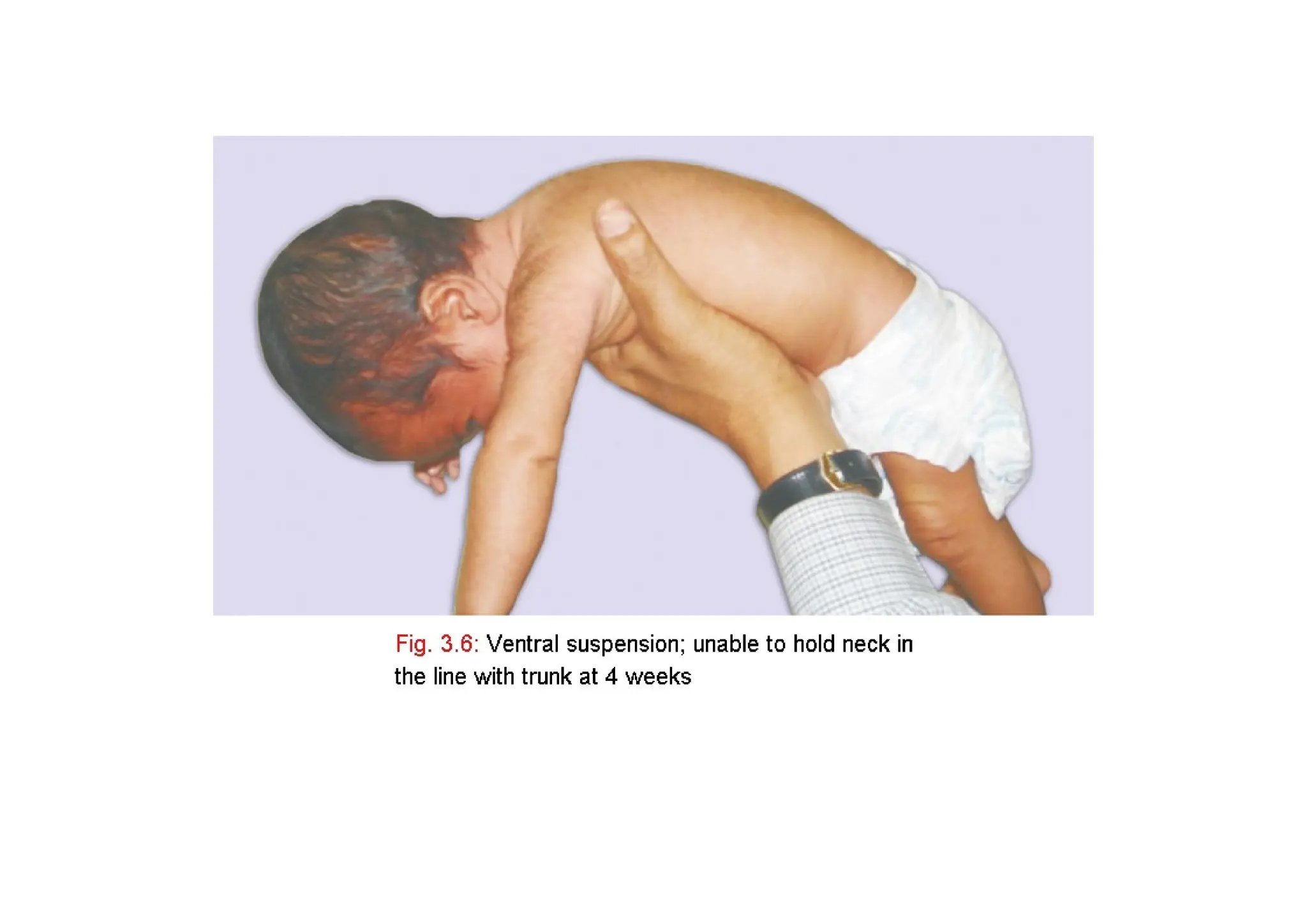 Developmental milestones - paediatrics neonatology | PPTX