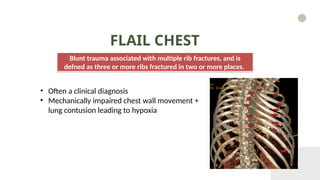 The presentation on the topic Chest Injury | PPTX
