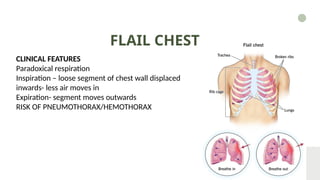 The presentation on the topic Chest Injury | PPTX