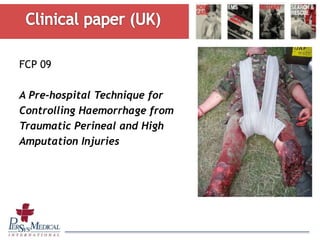 FCP 09
A Pre-hospital Technique for
Controlling Haemorrhage from
Traumatic Perineal and High
Amputation Injuries
 