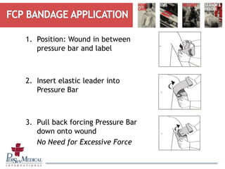 1. Position: Wound in between
pressure bar and label
2. Insert elastic leader into
Pressure Bar
3. Pull back forcing Pressure Bar
down onto wound
No Need for Excessive Force
 